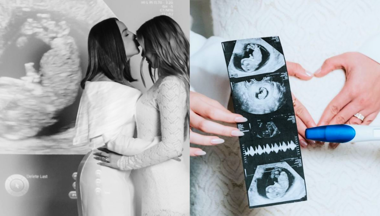 Mari Fernandez e Júlia Ribeiro anunciam que estão esperando um bebê